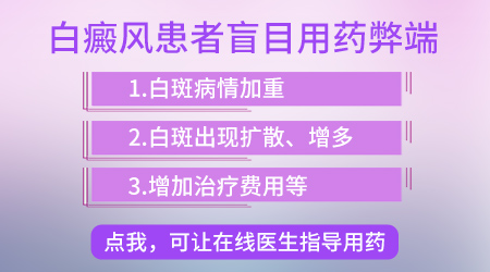 白癜风发作到底有什么特点呢?